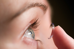 Einführung einer Kontaktlinse in das Auge