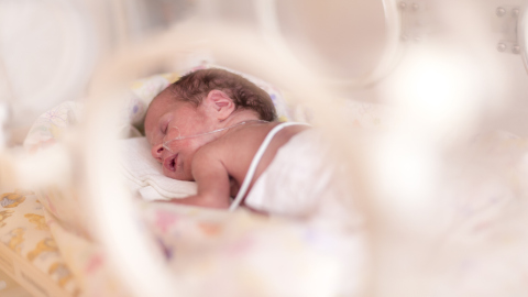 Frühgeburt für neugeborene Babys – Mädchen – Stockfoto