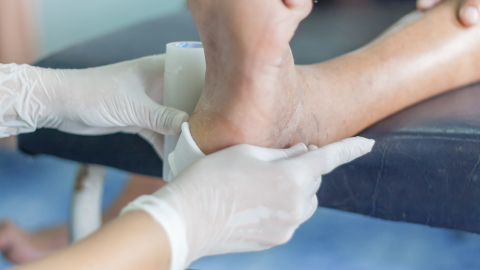 Versorgung einer infizierten Wunde des diabetischen Fußes - istockfoto.com/MangTeng