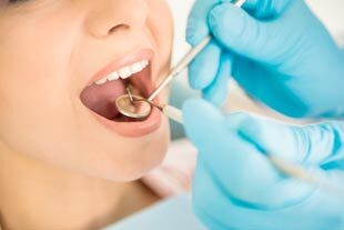 Unterscuhung beim Zahnarzt